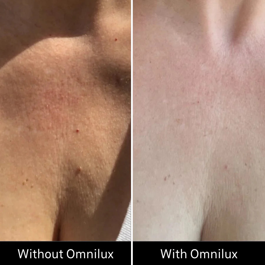 Contour Neck & Décolleté