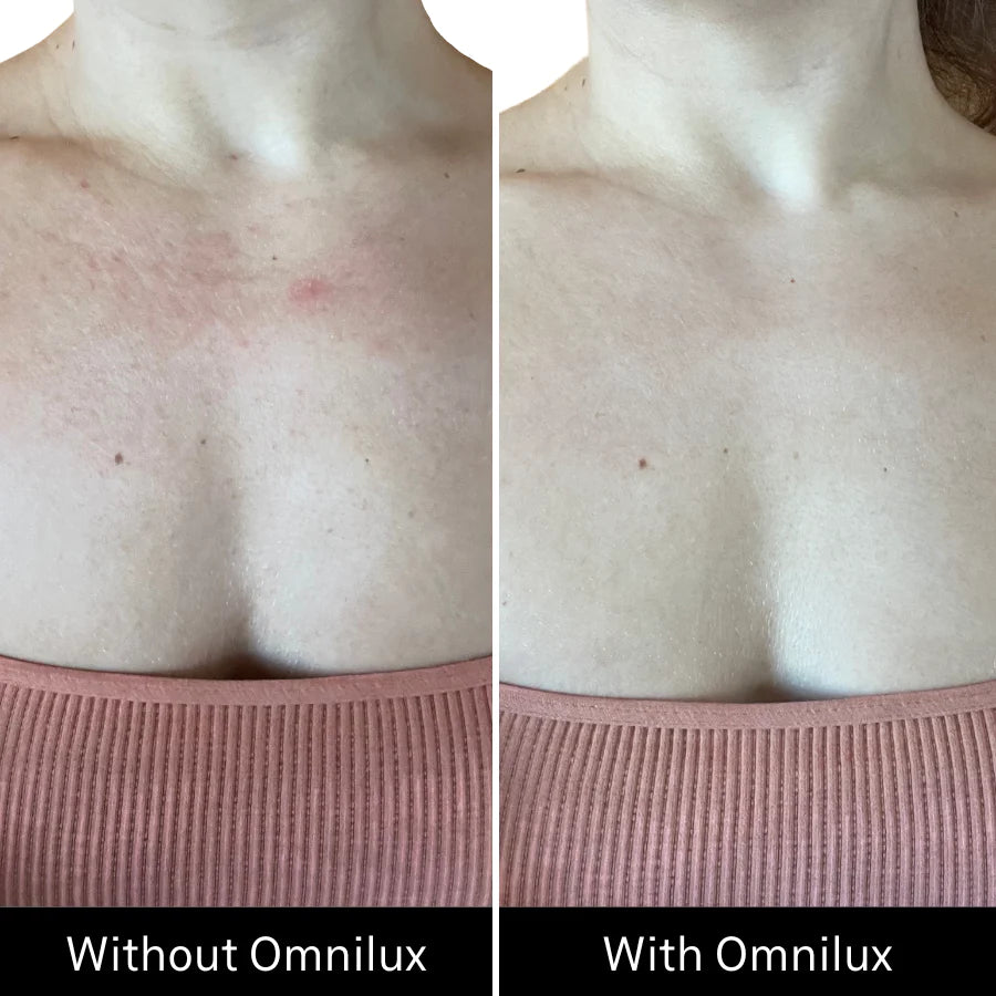 Contour Neck & Décolleté